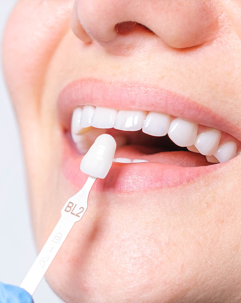 Treatment -  Heralds Way Dental