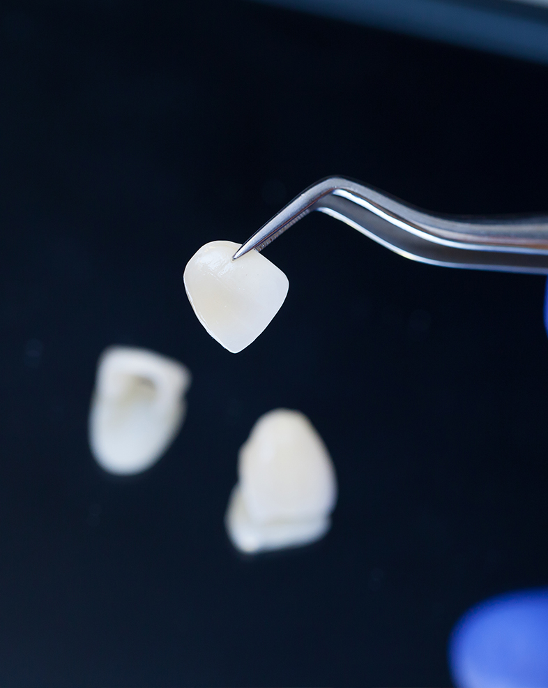 Treatment -  Heralds Way Dental