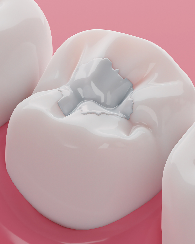 Treatment -  Heralds Way Dental