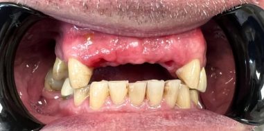 Before - Heralds Way Dental
