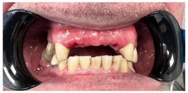 Before - Heralds Way Dental
